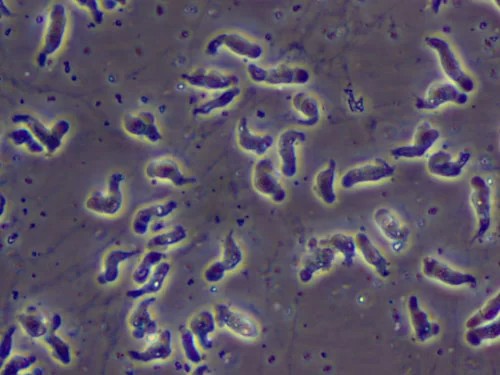 네글레리아 파울러리'를 현미경으로 600배 확대해 본 모습. [사진=미국 질병통제예방센터(CDC)]